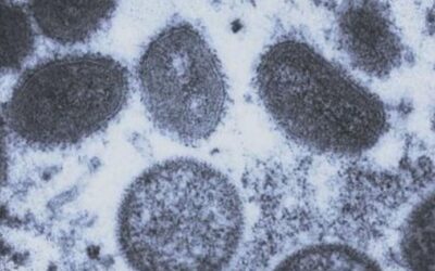 Arizona Health Department Issues Ambiguous Warnings on Monkeypox Spread