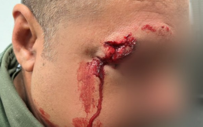 Biggs Calls Out ‘Lawlessness’ Of Assault Against Border Patrol Agent