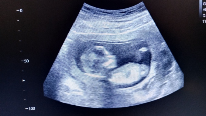 15-week ultrasound