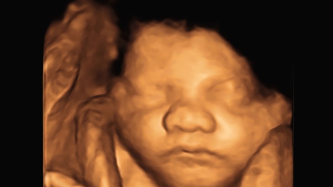 The Devil’s Brief: The Abortion Industry Vs. Arizona’s Preborn Children